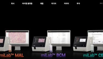[노을 딥시크③]또 다가오는 유증의 그림자…연말이 고비