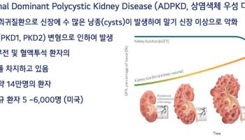 메지온, 신장병 신약에 별도 ‘가격표’…美법인 세워 M&A까지 노린다