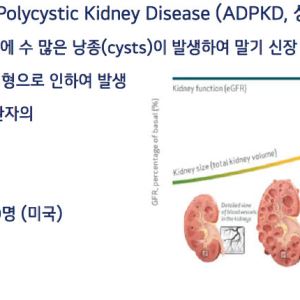 메지온, 신장병 신약에 별도 ‘가격표’…美법인 세워 M&A까지 노린다