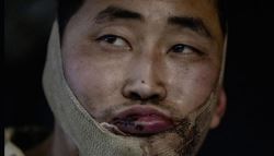 젤렌스키 “북한군 포로 2명 한국 보내”…정부, 사실상 인정