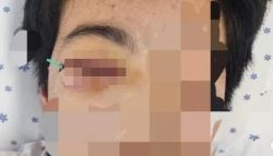 학폭에 안와골절...교장 가해자를 보디가드로, 내 일이라면? [이슈톡톡]